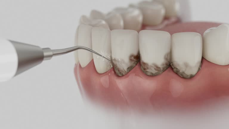 Reliable Dental contractor in Boonville, CA by Smile Center Dentistry